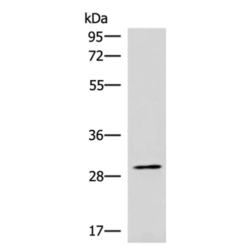 CDK4 rabbit polyclonal antibody