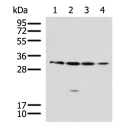 RCHY1 rabbit polyclonal antibody