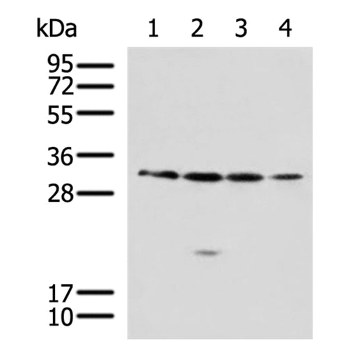 RCHY1 rabbit polyclonal antibody