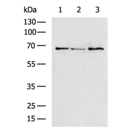 CACNB1 rabbit polyclonal antibody