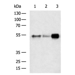 FGL2 rabbit polyclonal antibody