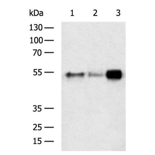FGL2 rabbit polyclonal antibody