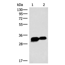 HCCS rabbit polyclonal antibody