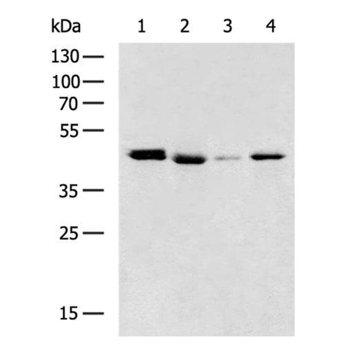 HMGCLL1 rabbit polyclonal antibody
