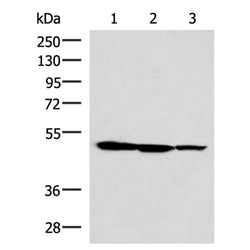 TTC38 rabbit polyclonal antibody