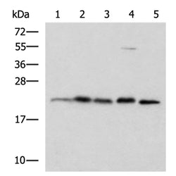 HPCAL1 rabbit polyclonal antibody