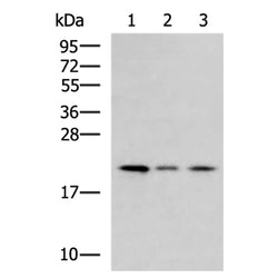 MRPL22 rabbit polyclonal antibody