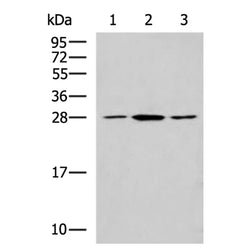 CLTB rabbit polyclonal antibody