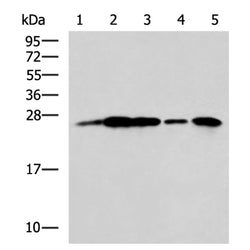 UCHL1 rabbit polyclonal antibody