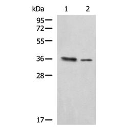 PDCL rabbit polyclonal antibody