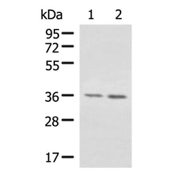 AIMP1 rabbit polyclonal antibody