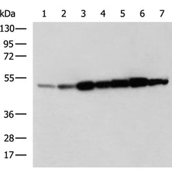 BECN1 rabbit polyclonal antibody