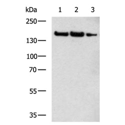 ERBB2 rabbit polyclonal antibody