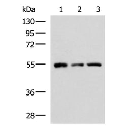 RAD52 rabbit polyclonal antibody