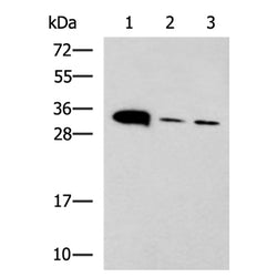PSCA rabbit polyclonal antibody