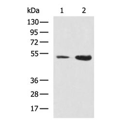 STK11 rabbit polyclonal antibody