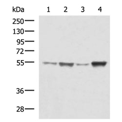 TUBB2A rabbit polyclonal antibody