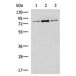 BAP1 rabbit polyclonal antibody
