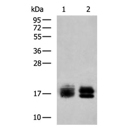 NPC2 rabbit polyclonal antibody