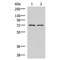 MKS1 rabbit polyclonal antibody