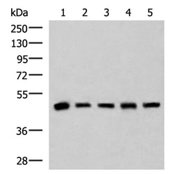 PCYT2 rabbit polyclonal antibody