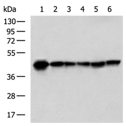 PDHA1 rabbit polyclonal antibody