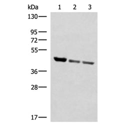 SCCPDH rabbit polyclonal antibody