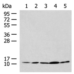PAM16 rabbit polyclonal antibody