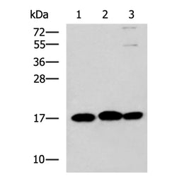 RPS14 rabbit polyclonal antibody