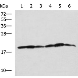 BLOC1S6 rabbit polyclonal antibody