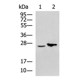 NABP1 rabbit polyclonal antibody