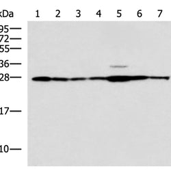 RPL10A rabbit polyclonal antibody