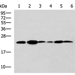 TMED10 rabbit polyclonal antibody