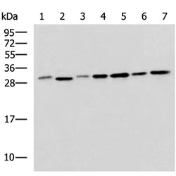 EXOSC4 rabbit polyclonal antibody