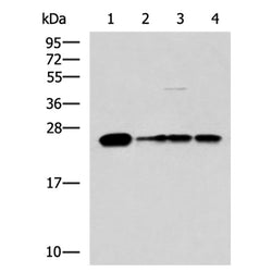 MMAB rabbit polyclonal antibody