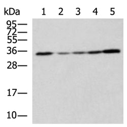 STX6 rabbit polyclonal antibody