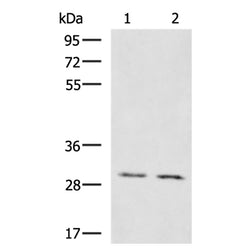KRCC1 rabbit polyclonal antibody