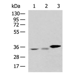 PDXK rabbit polyclonal antibody