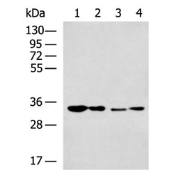 PRKRA rabbit polyclonal antibody