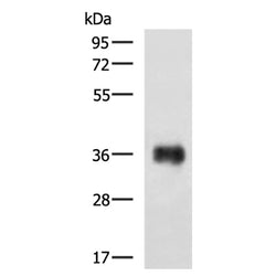EPCAM rabbit polyclonal antibody