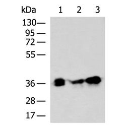PYCR2 rabbit polyclonal antibody