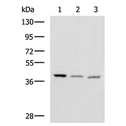 ENKD1 rabbit polyclonal antibody