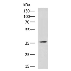 IBSP rabbit polyclonal antibody