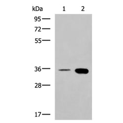 MAF rabbit polyclonal antibody