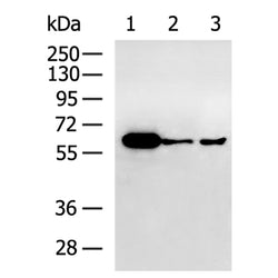 SQSTM1 rabbit polyclonal antibody