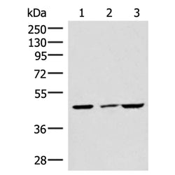 IP6K2 rabbit polyclonal antibody