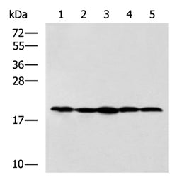 RPS11 rabbit polyclonal antibody