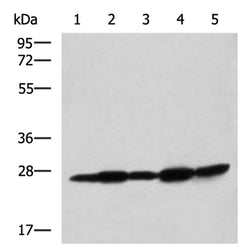 QDPR rabbit polyclonal antibody