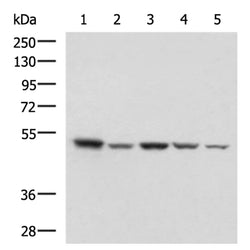 ENO3 rabbit polyclonal antibody