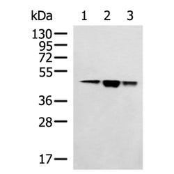 HSDL2 rabbit polyclonal antibody